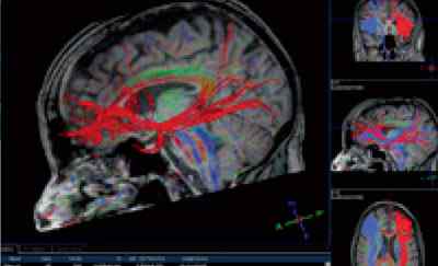Anewtech-Systems-ai-embedded-pc-ai-application-medical