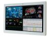 Anewtech Systems Medical Touch Computer IEI Medical Panel PC I-POCm-W24C-ULT3